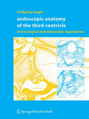 cover image of Endoscopic Anatomy of the Third Ventricle